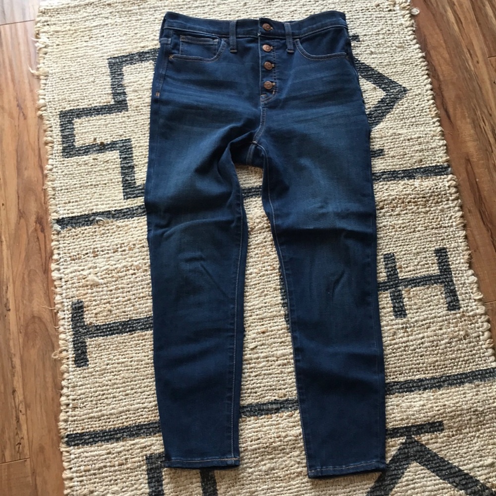 Madewell Button Front 10” High-Rise Skinny Jeans